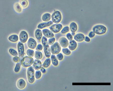 Yeast cells under the microscope