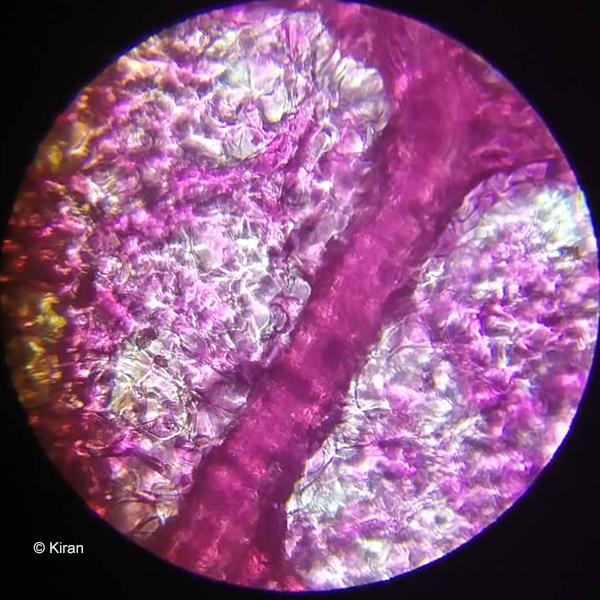 Bougainvillea under the microscope at 45x.