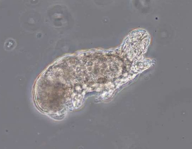 Waterbear in wastewater under the microscope