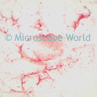 Helicobacter Pylori Microscope Image
