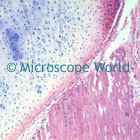 larynx microscope image