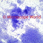 Pneumonia Microscope Image