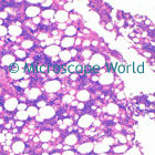 Bone Marrow Microscope Image