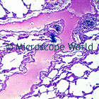 lung microscope image