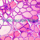 Thyroid Gland Microscope Image