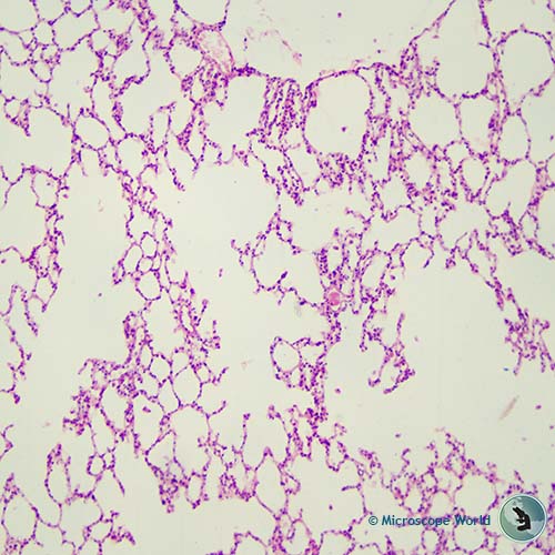 Rabbit lung at 100x magnification