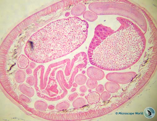 Ascaris cross section