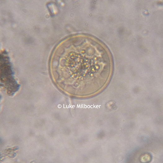 Arcella under the Microscope at 400x