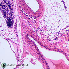 Artery and Vein Under the Microscope