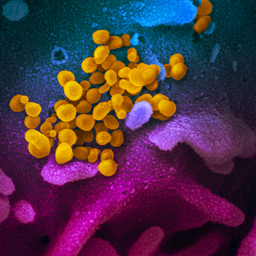 SEM Image of Virus that Causes COVID-19 SEM Image of Virus that Causes COVID-19