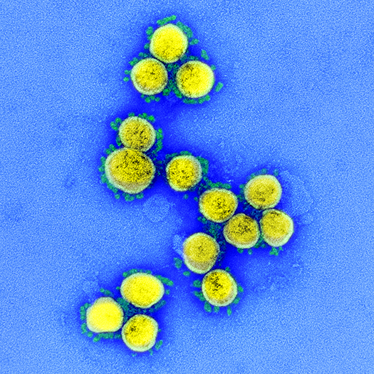 SARS-CoV-2 Under the Microscope