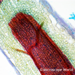 Capsella under microscope