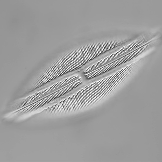 Microscope DIC Image of Navicula Lyra