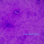 E. Coli under microscope
