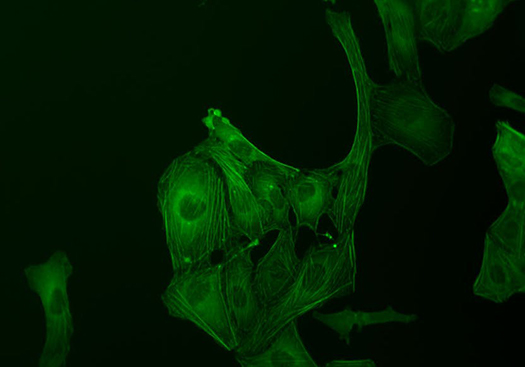 Fluorescence Microscopy U2OS Cells using GFP 