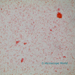 Helicobacter Pylori under microscope