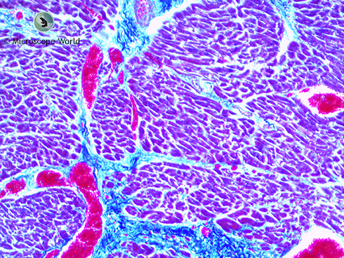 Human cardiac muscle under the microscope at 100x.