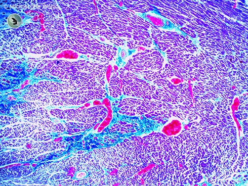 Human Cardiac Muscle under the Microscope at 40x