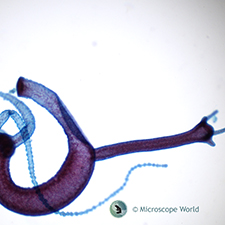 Hydra with Bud under Microscope
