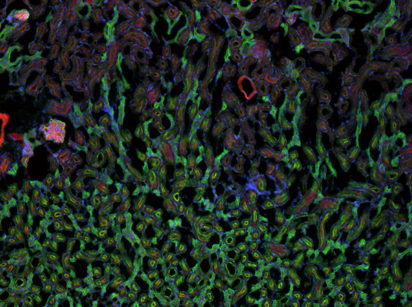 Lumenera Infinity 3S-1UR Microscope Camera Image of Mouse Kidney