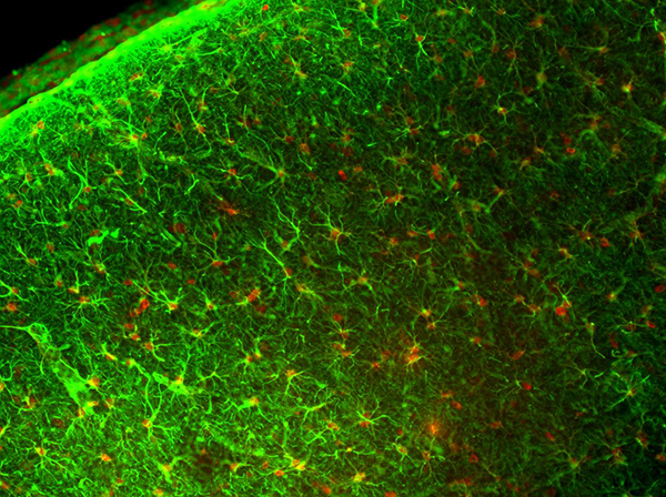 Rat brain captured under fluorescence microscope at 100x using Lumenera 3S-1UR microscope camera.