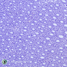 Kidney under the Microscope