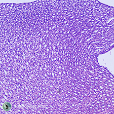 Kidney Under the Microscope