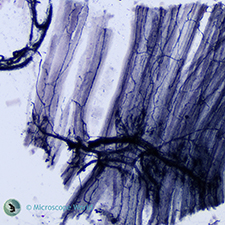 Motor Nerve Ending Under the Microscope
