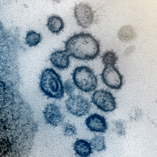 Virus that Causes COVID-19 Under the Transmission Electron Microscope