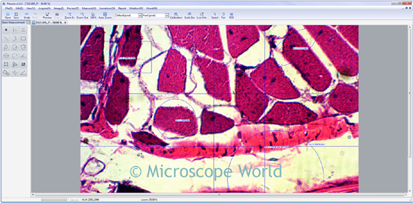 Panasis Measurement Image