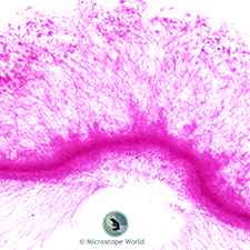 Penicillium under the Microscope