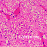 Pituitary Body