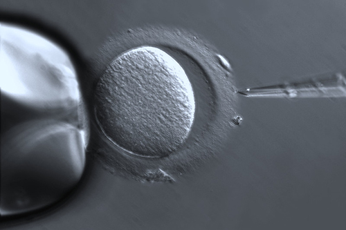 Oocyte Microscopy Image with PlasDIC