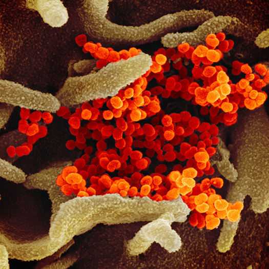 Scanning Electron Microscope Image of Virus that Causes COVID-19