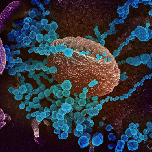 scanning electron microscope virus