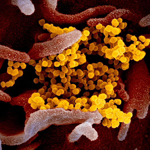 Scanning Electron Microscope Image of the virus that causes COVID-19.