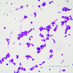 Sarcina bacteria under microscope