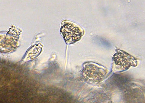 ciliates under microscope