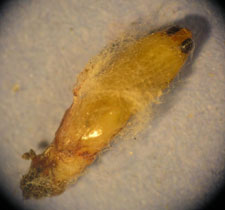 Moth Pupa Under Stereo Microscope 30x