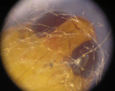 Moth Pupa Under Stereo Microscope at 60x