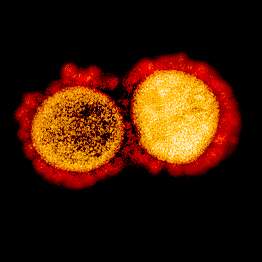 Corona Virus Captured Under the Microscope