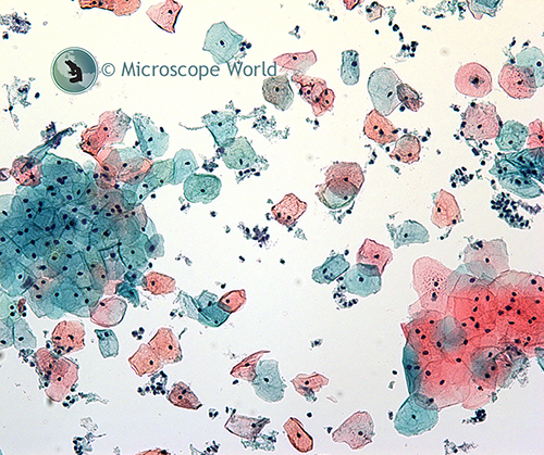 ThinPrep Pap smear image under the microscope.