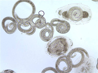 Usando microscópios para testar a carne quanto à presença de minhocas de Trichinella Bear_muscle_tissue100x_trichinella