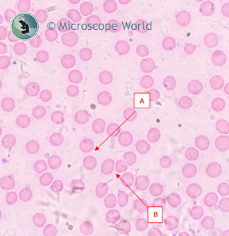 Blood cells under the microscope