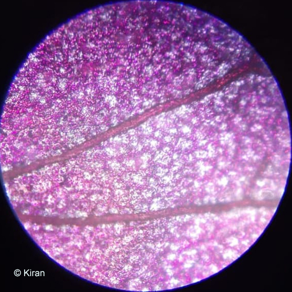 Bougainvillea under the microscope at 10x