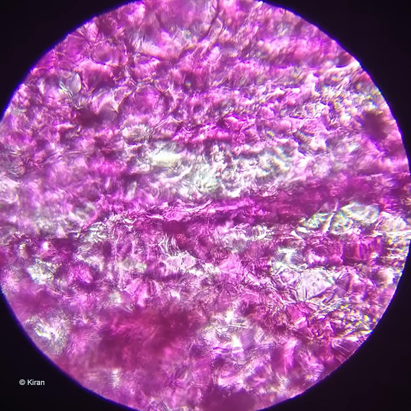 Bougainvillea under the microscope at 45x.