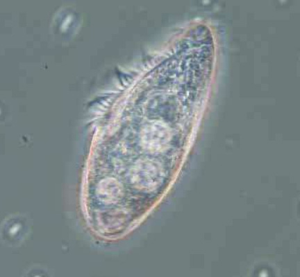 ciliates under microscope