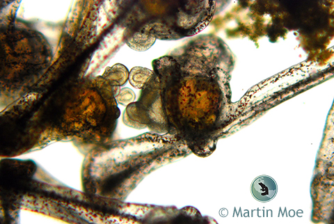 Diadema Antillarum Larva under the Microscope