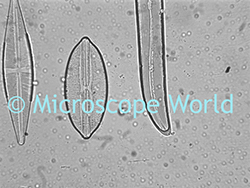 Dirty Microscope Lens Image