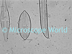 Dirty Microscope Lens Image
